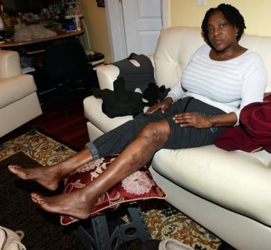 美國怎么處理電梯“吃人”?賠死你