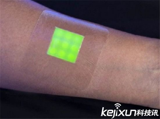 智能繃帶對抗細菌感染 每年可拯救上萬人