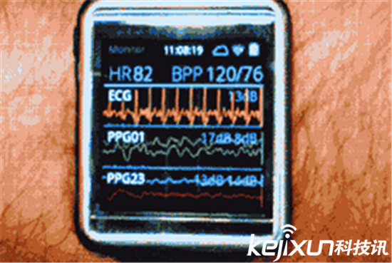 你真的需要一塊iwatch？iwatch功能介紹