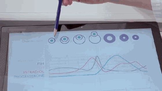 這事有點污 夫妻想懷孕居然靠這款手環就行了